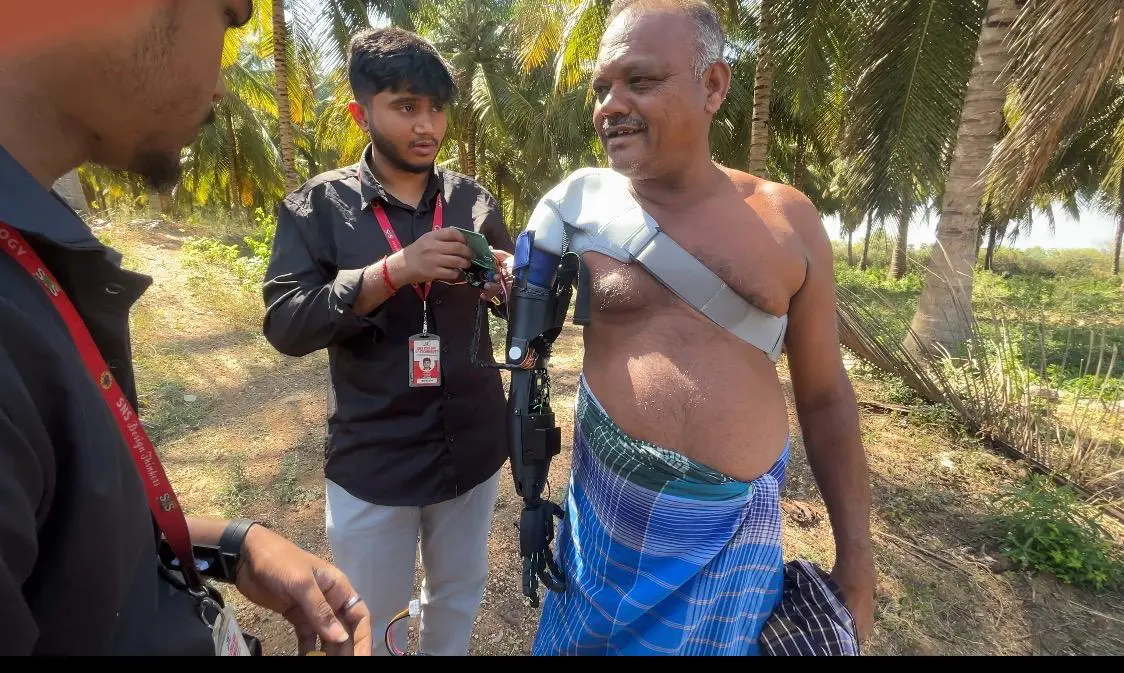 Real-world prosthetic challenges